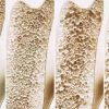 Perosi Catat 41,7 Persen Warga Kena Osteopenia, Ini Kunci Mencegah Osteoporosis Sejak Dini