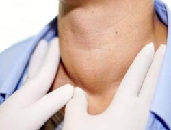 Selain Cegah Gondok, Ini Sederet Khasiat Lodine bagi Tubuh