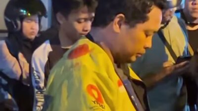 Nyaris Jadi Korban Begal, Driver Maxim di Pontianak Alami Luka Bacok